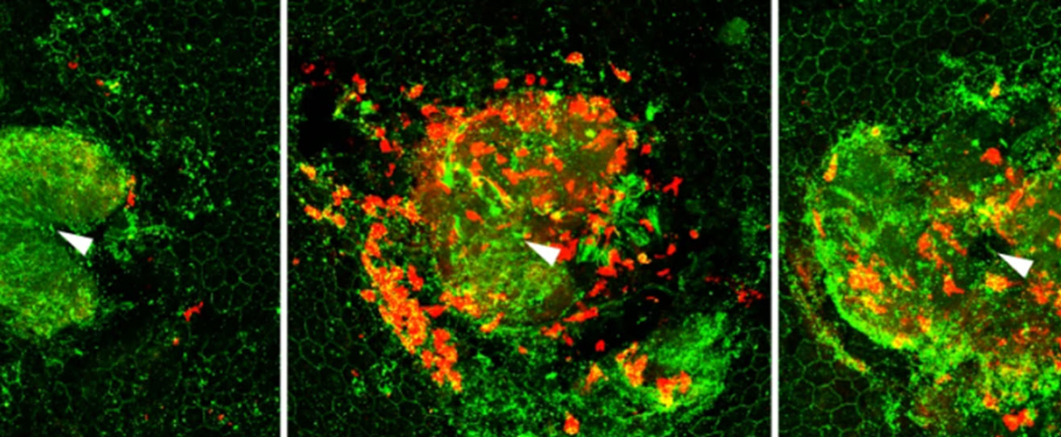 Mice retina 